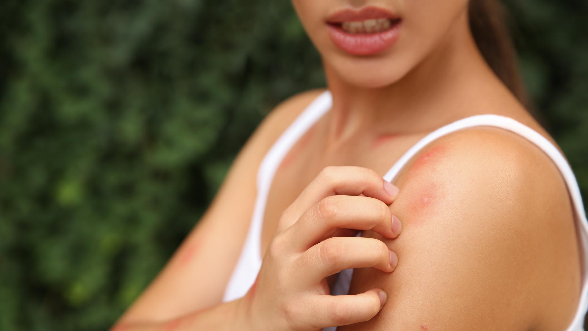 O que é tosse alérgica? Aprenda a fazer um remédio caseiro 